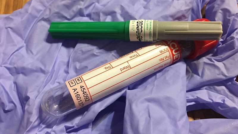 Dubai man accused of taking medical test for friend with hepatitis