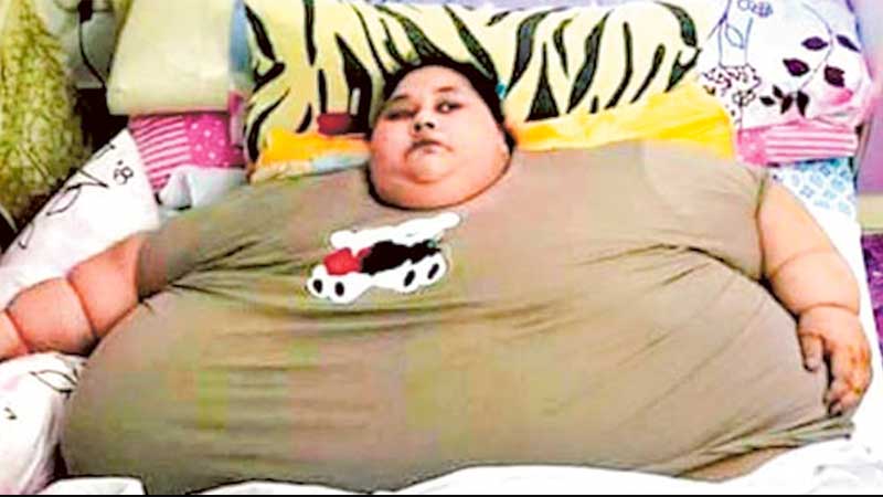 World's heaviest woman to defy all odds for life-changing surgery