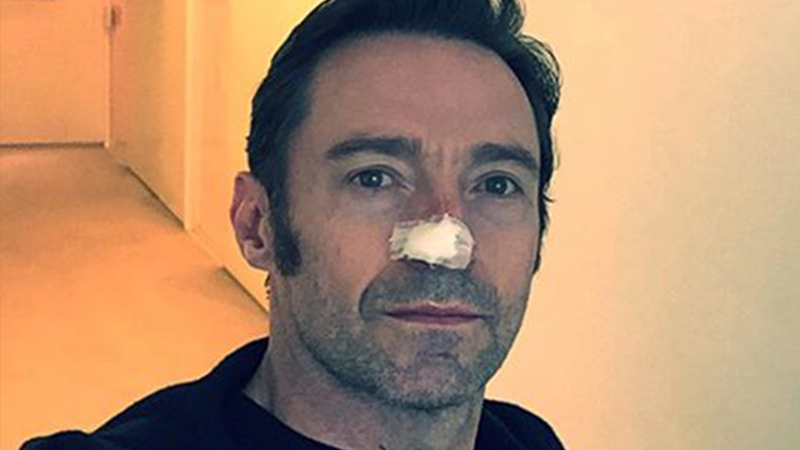 Hugh Jackman suffers fifth bout with skin cancer