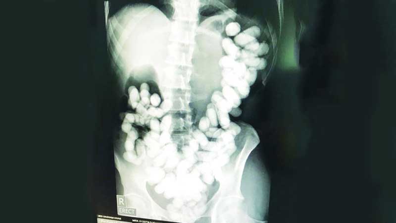 Passenger caught smuggling cocaine in intestines at Abu Dhabi airport