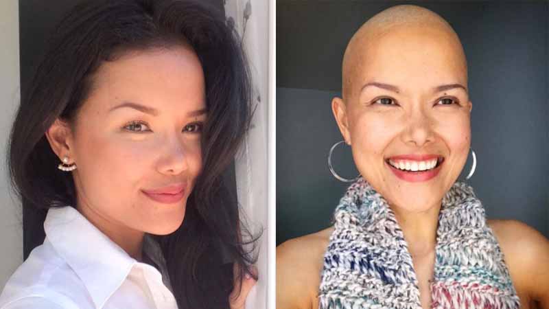 Jaymee Joaquin's brave fight against breast cancer