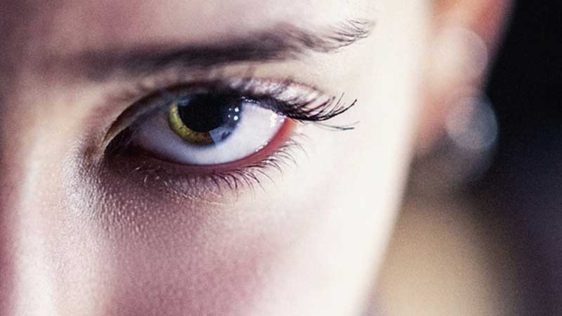 14 worms removed from woman's eye