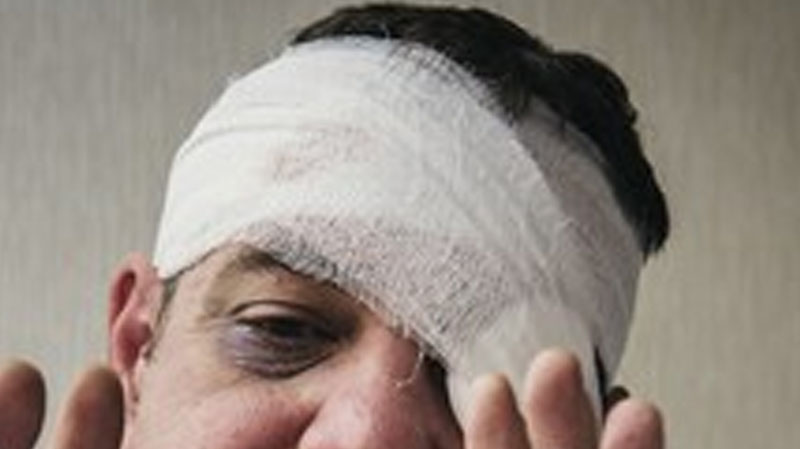 Etisalat driver loses eye in attack by 3 brothers