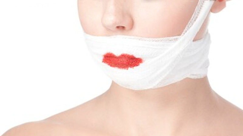 Dubai expat jailed for biting off friend’s lip