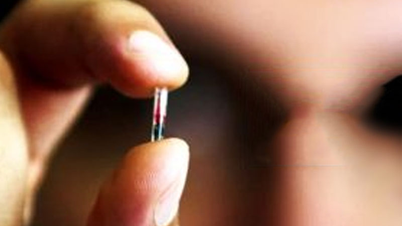 microchip implant