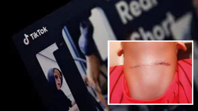 Choking challenge spreading in UAE: Ajman boy injured