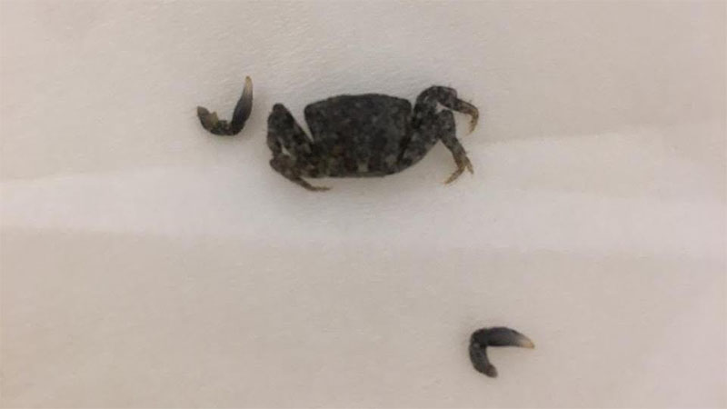 Live crab removed from Abu Dhabi beachgoer’s ear