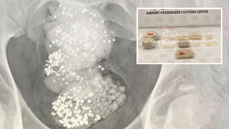 Man who swallowed $90,000 worth of diamonds caught in Sharjah