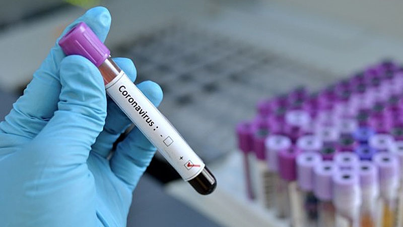 UAE develops test to detect Covid-19 in asymptomatic patients