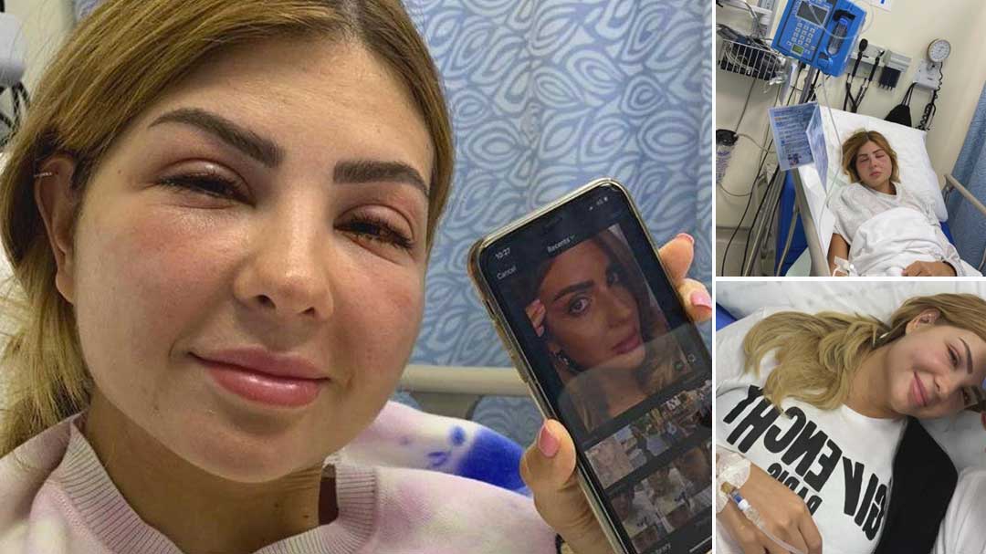 Dubai influencer raises alarm after eyelash treatment goes horribly wrong