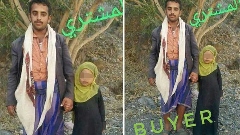 Father sells daughter for $798 in Yemen