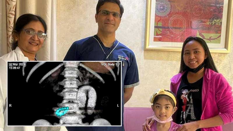 Filipino child who swallowed magnetic beads saved in Abu Dhabi