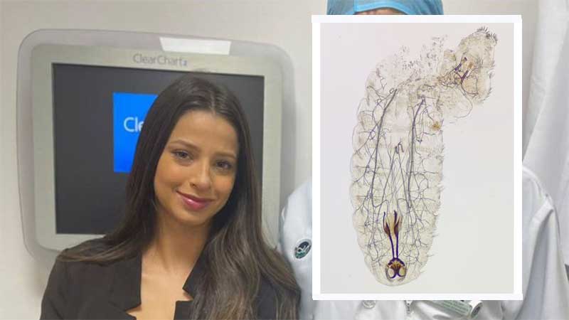 Brazilian expat gets flesh-eating parasite in her eye on Ras Al Khaimah hike