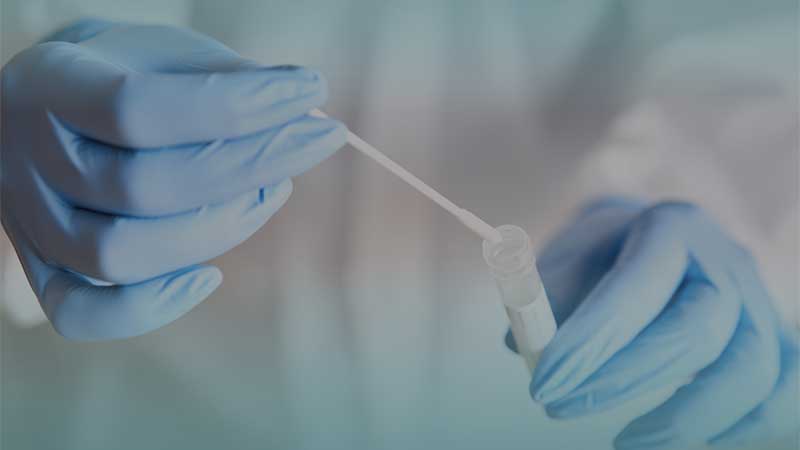 UAE health authority warns clinics against PCR test overpricing