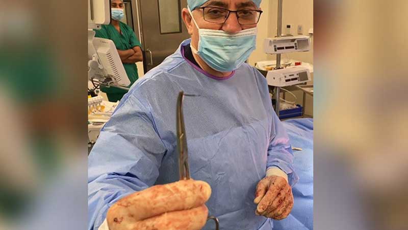 UAE doctors remove broken needle left in African expat's pelvis for 10 years