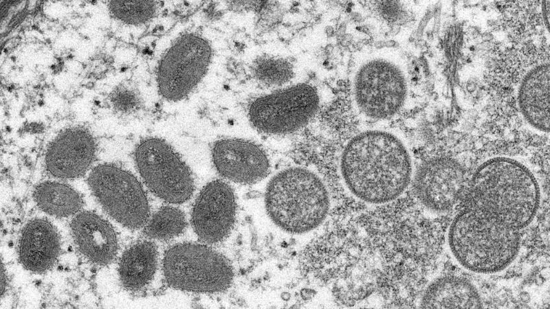 UAE records 3 new cases of monkeypox