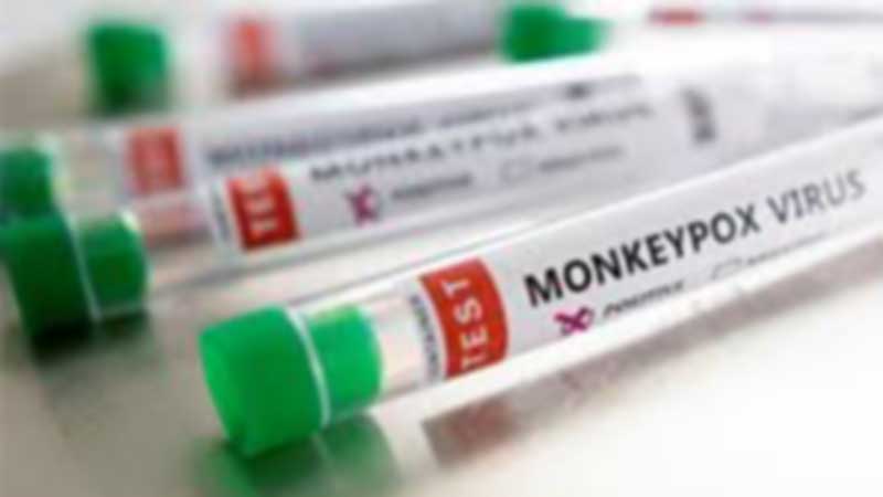 PCR tests: How the monkeypox virus is detected