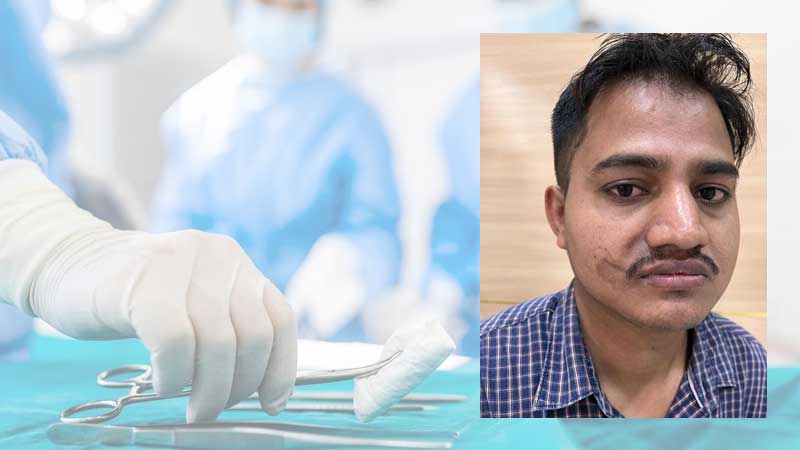 Indian expat in UAE gets face back after accident at work