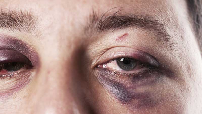 Man beaten up in Al Ain gets Dh30,000 in compensation