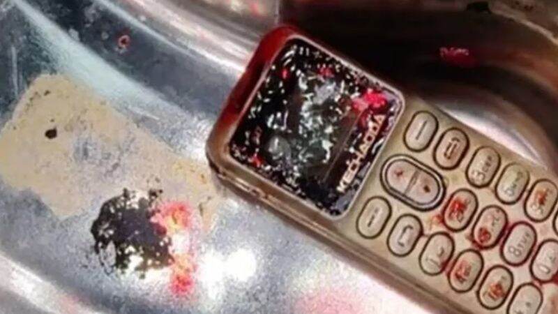 India: Girl swallows phone during dispute with brother