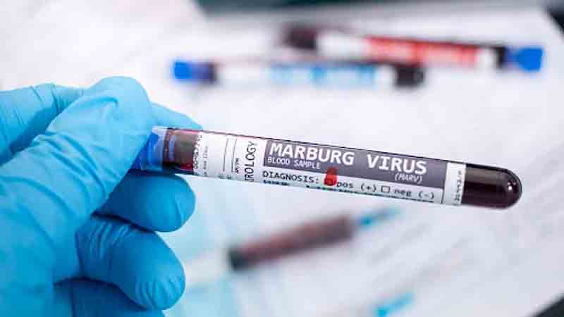 UAE residents told to isolate if returning from Marburg-hit countries