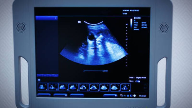 Abu Dhabi University Develops Portable Ultrasound Machines to Save Lives