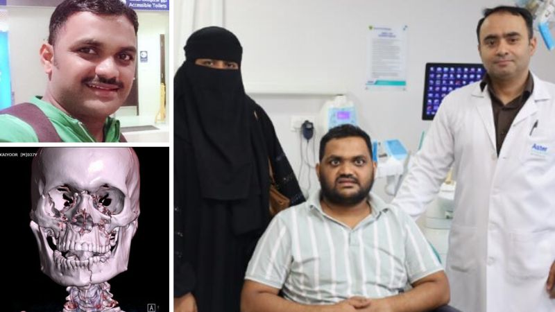 Dubai: Indian delivery rider gets new lease on life after accident crushes his face