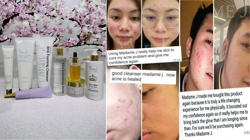 Expats in UAE rave about Korean-made Madame J skincare: ‘It gave me back my confidence’